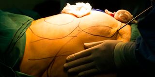 The first step to managing a plastic surgery addiction is to admit that you have the problem and need help.