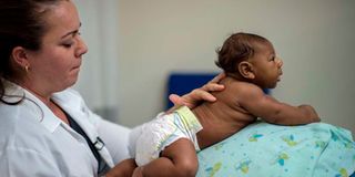 Zika Virus