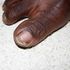 toes