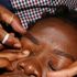 Threading technic for eye dressing. 