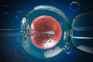 IVF
