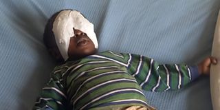 Baby Sagini eyes gouged out