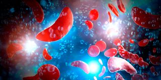 sickle cell