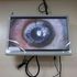 Cornea 