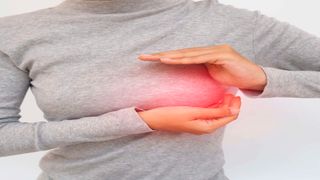 Breast cancer