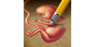 miscarriage (1)