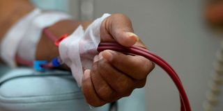 Dialysis