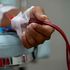 Dialysis